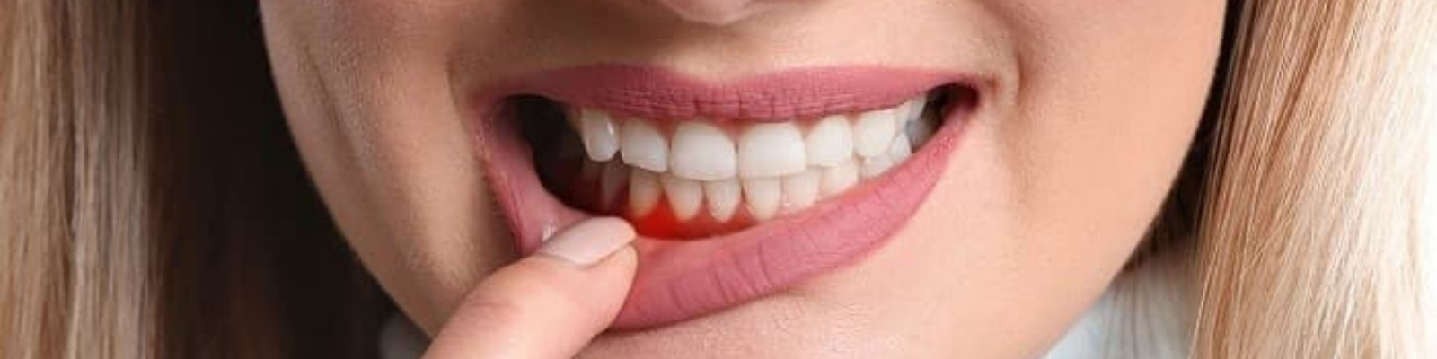 Periodontics (Gum Treatments)